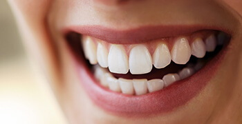smile with dental sealants